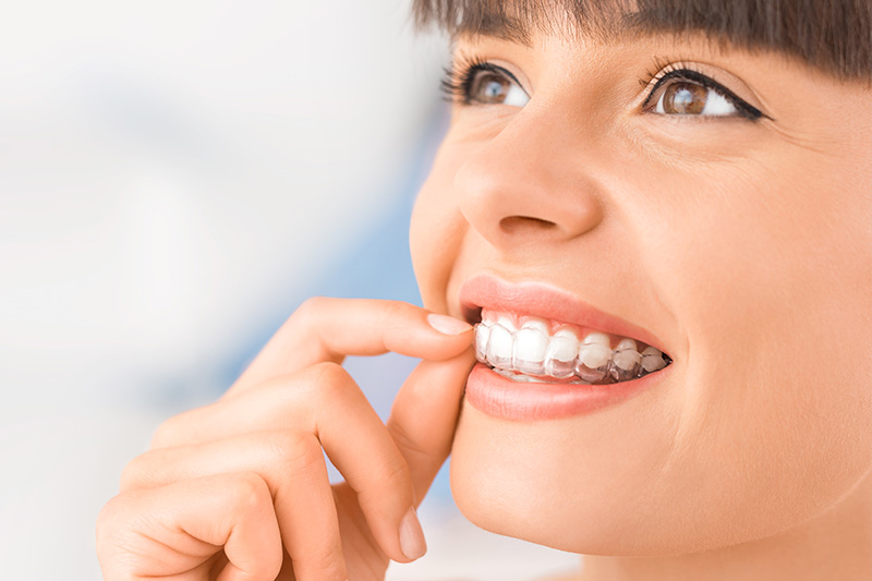 Invisalign in Havertown